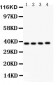 Anti-IKB Beta Picoband Antibody